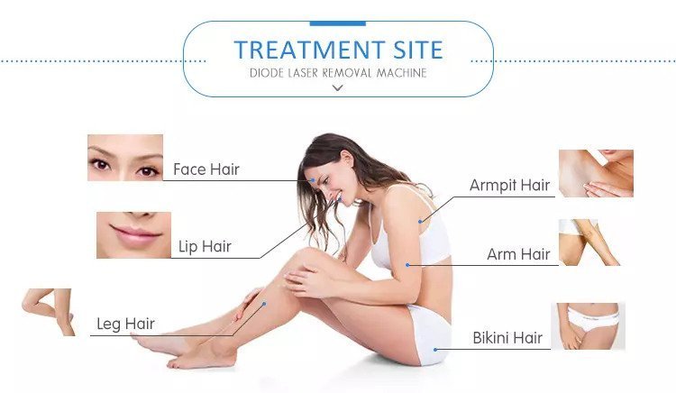HAIR REMOVAL (DIODE LASER) - Image 4
