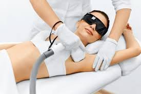 HAIR REMOVAL (DIODE LASER) - Image 3